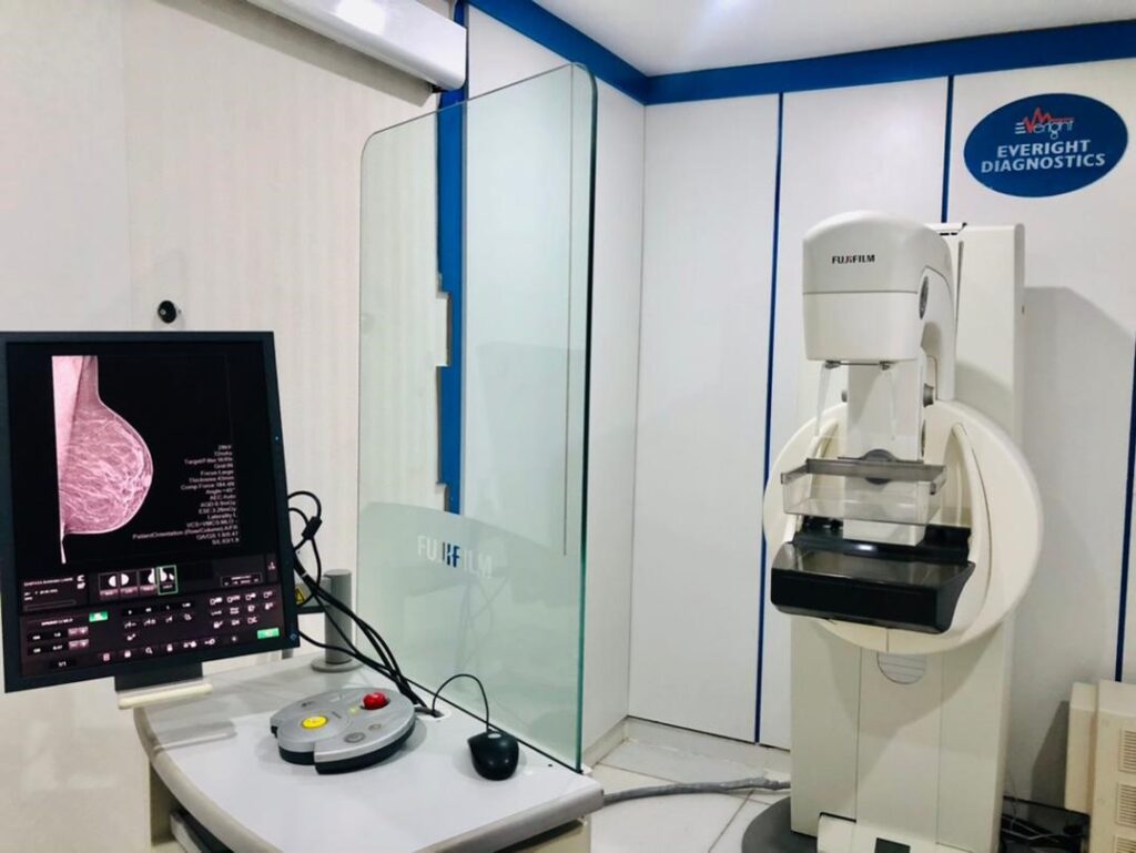 Mammogram room at Everight Diagnostics Abuja